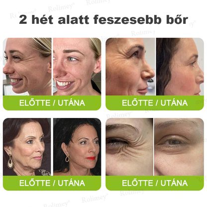 🌸Rolimey®Krema za učvršćivanje bora s botoksom i Vita-A retinolom ⏰ Zadnji dan! 70% popusta💡
