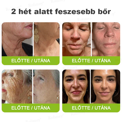 🌸Rolimey®Krema za učvršćivanje bora s botoksom i Vita-A retinolom ⏰ Zadnji dan! 70% popusta💡