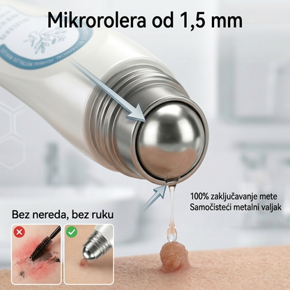 𝐏i𝐜𝐝o® 𝟕-𝐝𝐧𝐞𝐯𝐧𝐢 𝐨𝐝𝐬𝐭𝐫𝐚𝐧𝐣𝐢𝐯𝐚č 𝐛𝐫𝐚𝐝𝐚𝐯𝐢𝐜𝐚 𝐢 𝐦𝐫𝐥𝐢𝐚(Rollerball bez boli, bez ožiljaka)💪