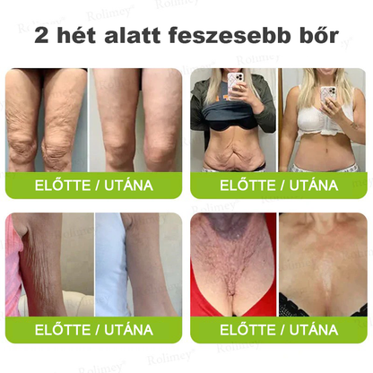🌸Rolimey®Krema za učvršćivanje bora s botoksom i Vita-A retinolom ⏰ Zadnji dan! 70% popusta💡