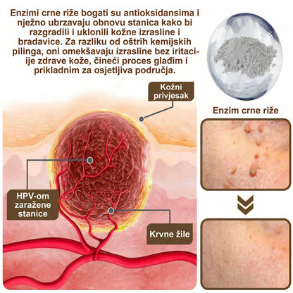 FIVFIVGO® Umirujuća krema za obnovu s crnom i bijelom rižom👨‍⚕️Odobrena od strane HALMED (Uklanjanje bradavica i kožnih izraslina, senilne purpure, angioma trešnje, raka kože i seboroične keratoze.👨‍⚕️