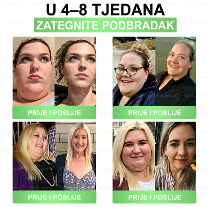 👉Službena certifikacija🔥 Tisuće zadovoljnih korisnika u Hrvatskoj💗🥰𝐆𝐞𝑒𝐿𝑒𝐦𝐨𝐧® 𝐆𝐥𝐮𝐦𝐚𝐬𝐞𝐭𝐢𝐝𝐞 8 IN 1" TANAK I ZDRAV MIKROIGLICNI FLASTER S NANOPARTIKLAMA (Samo jednom dnevno, vidljive promjene za 7 dana)  ✅