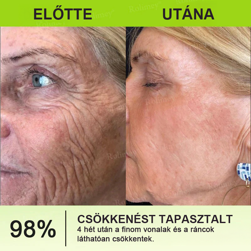 🌸Rolimey®Krema za učvršćivanje bora s botoksom i Vita-A retinolom ⏰ Zadnji dan! 70% popusta💡