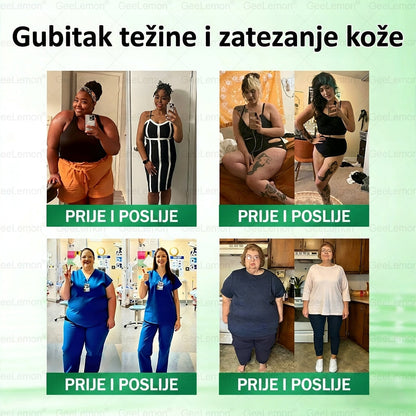 👉Službena certifikacija🔥 Tisuće zadovoljnih korisnika u Hrvatskoj💗🥰𝐆𝐞𝑒𝐿𝑒𝐦𝐨𝐧® 𝐆𝐥𝐮𝐦𝐚𝐬𝐞𝐭𝐢𝐝𝐞 8 IN 1" TANAK I ZDRAV MIKROIGLICNI FLASTER S NANOPARTIKLAMA (Samo jednom dnevno, vidljive promjene za 7 dana)  ✅