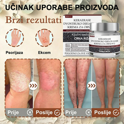 FIVFIVGO® Umirujuća krema za obnovu s crnom i bijelom rižom👨‍⚕️Odobrena od strane HALMED (Uklanjanje bradavica i kožnih izraslina, senilne purpure, angioma trešnje, raka kože i seboroične keratoze.👨‍⚕️