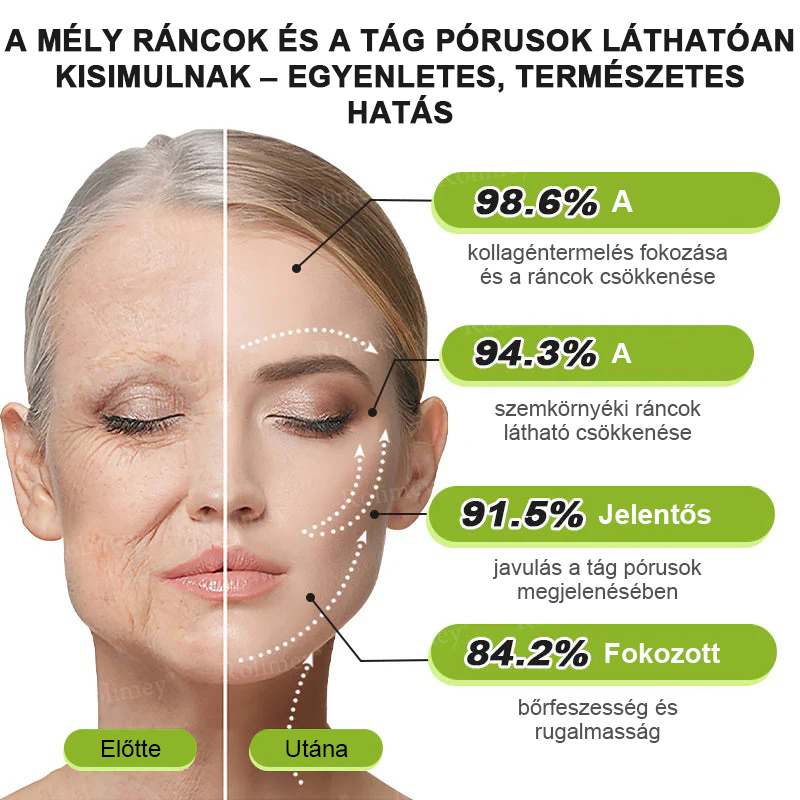 🌸Rolimey®Krema za učvršćivanje bora s botoksom i Vita-A retinolom ⏰ Zadnji dan! 70% popusta💡