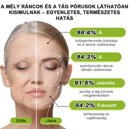 🌸Rolimey®Krema za učvršćivanje bora s botoksom i Vita-A retinolom ⏰ Zadnji dan! 70% popusta💡