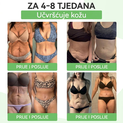 👉Službena certifikacija🔥 Tisuće zadovoljnih korisnika u Hrvatskoj💗🥰𝐆𝐞𝑒𝐿𝑒𝐦𝐨𝐧® 𝐆𝐥𝐮𝐦𝐚𝐬𝐞𝐭𝐢𝐝𝐞 8 IN 1" TANAK I ZDRAV MIKROIGLICNI FLASTER S NANOPARTIKLAMA (Samo jednom dnevno, vidljive promjene za 7 dana)  ✅