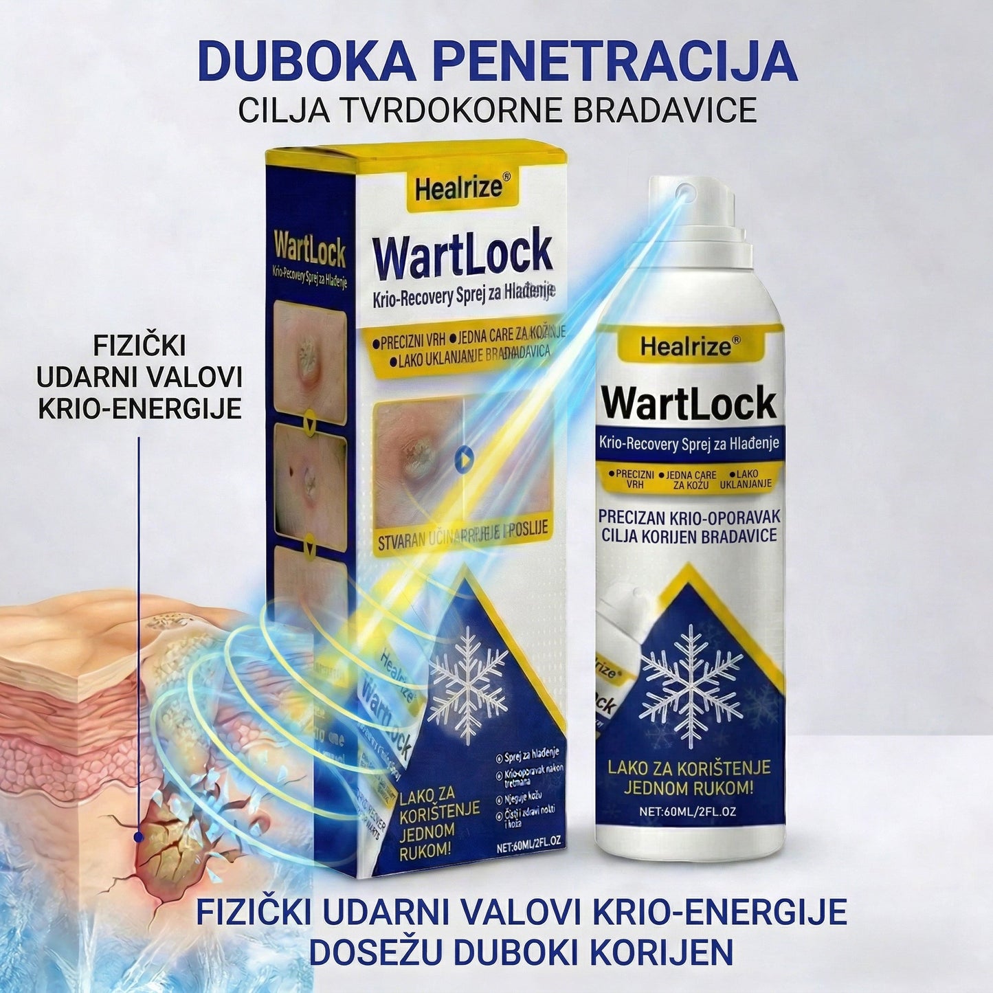 🏅𝑶𝒅𝒐𝒃𝒓𝒆𝒏𝒐 𝒐𝒅 𝒔𝒕𝒓𝒂𝒏𝒆 𝑻𝑮𝑨-𝒆 | Healrize® WartLock Krio-Recovery Sprej za Hlađenje