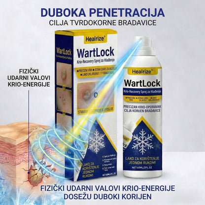 🏅𝑶𝒅𝒐𝒃𝒓𝒆𝒏𝒐 𝒐𝒅 𝒔𝒕𝒓𝒂𝒏𝒆 𝑻𝑮𝑨-𝒆 | Healrize® WartLock Krio-Recovery Sprej za Hlađenje