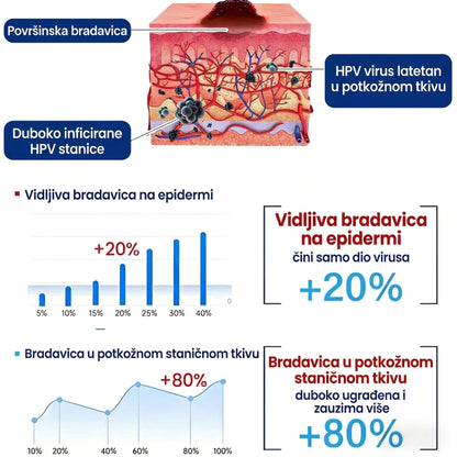 🏅𝑶𝒅𝒐𝒃𝒓𝒆𝒏𝒐 𝒐𝒅 𝒔𝒕𝒓𝒂𝒏𝒆 𝑻𝑮𝑨-𝒆 | Healrize® WartLock Krio-Recovery Sprej za Hlađenje
