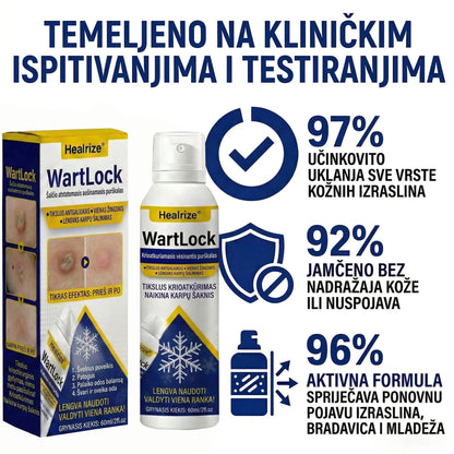 🏅𝑶𝒅𝒐𝒃𝒓𝒆𝒏𝒐 𝒐𝒅 𝒔𝒕𝒓𝒂𝒏𝒆 𝑻𝑮𝑨-𝒆 | Healrize® WartLock Krio-Recovery Sprej za Hlađenje