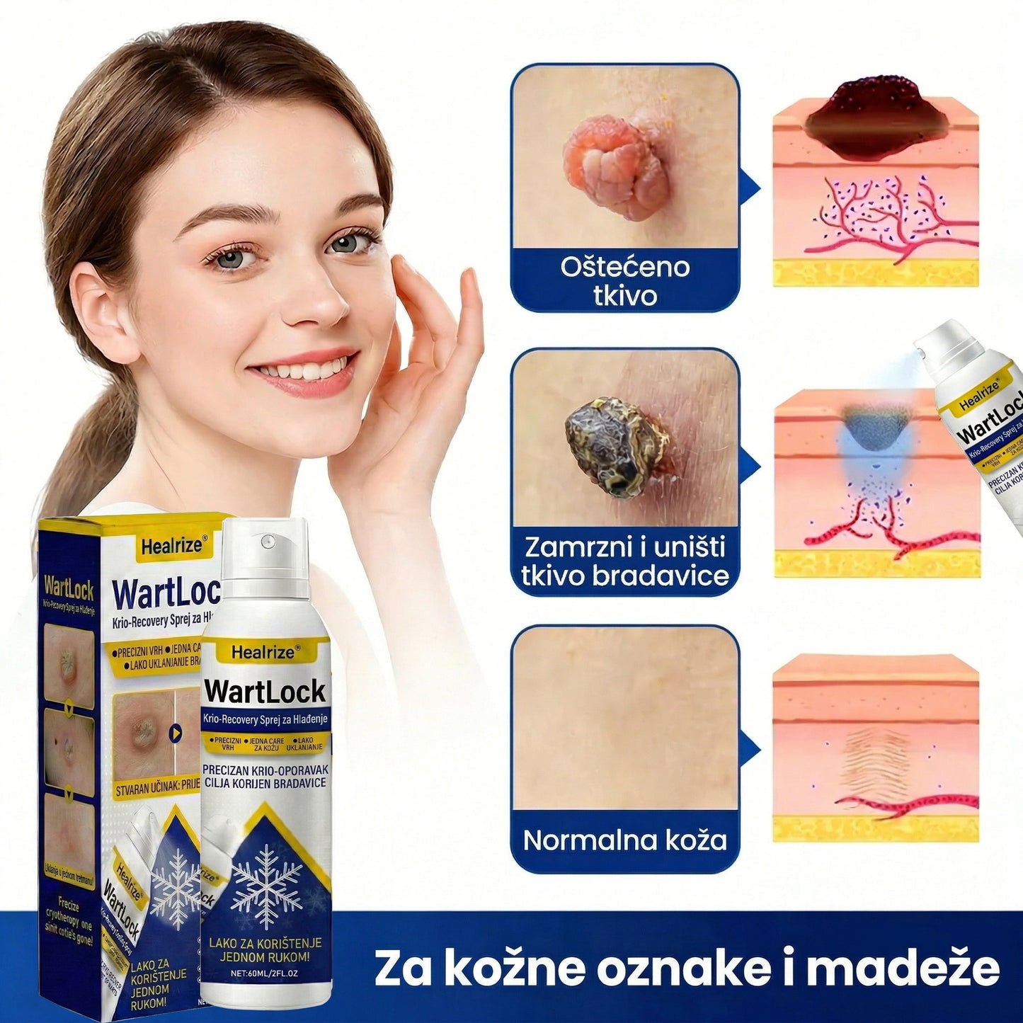 🏅𝑶𝒅𝒐𝒃𝒓𝒆𝒏𝒐 𝒐𝒅 𝒔𝒕𝒓𝒂𝒏𝒆 𝑻𝑮𝑨-𝒆 | Healrize® WartLock Krio-Recovery Sprej za Hlađenje