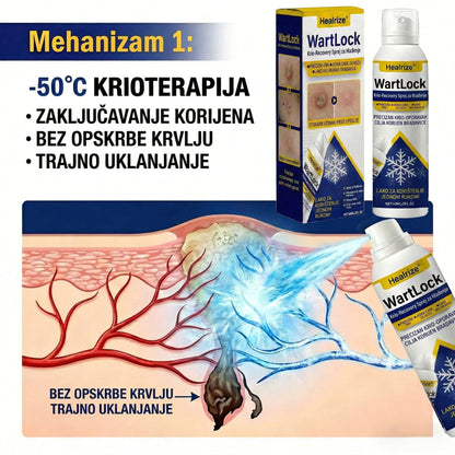 🏅𝑶𝒅𝒐𝒃𝒓𝒆𝒏𝒐 𝒐𝒅 𝒔𝒕𝒓𝒂𝒏𝒆 𝑻𝑮𝑨-𝒆 | Healrize® WartLock Krio-Recovery Sprej za Hlađenje