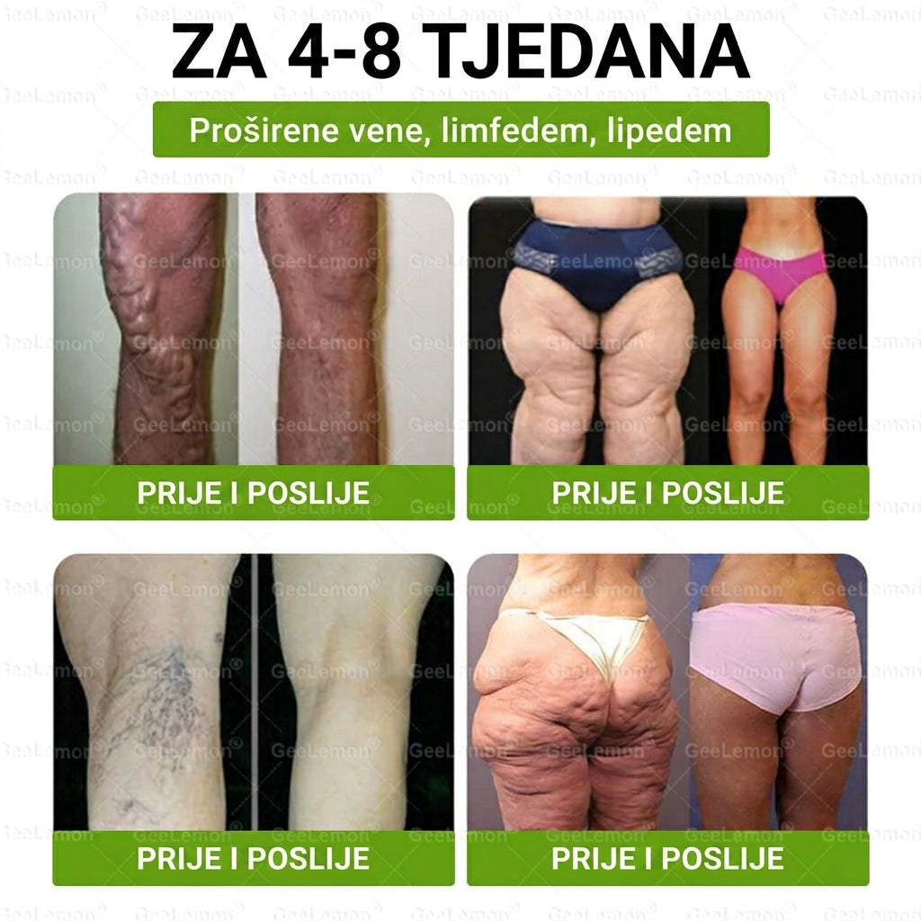 👉Službena certifikacija🔥 Tisuće zadovoljnih korisnika u Hrvatskoj💗🥰𝐆𝐞𝑒𝐿𝑒𝐦𝐨𝐧® 𝐆𝐥𝐮𝐦𝐚𝐬𝐞𝐭𝐢𝐝𝐞 8 IN 1" TANAK I ZDRAV MIKROIGLICNI FLASTER S NANOPARTIKLAMA (Samo jednom dnevno, vidljive promjene za 7 dana)  ✅