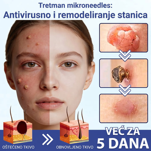 🔥Timilk® Dermalna Obnova 2-U-1 Mikroiglice & Hidrokoloidni flaster 💉| Sredstvo za uklanjanje podignutih madeža, akni, ravnih bradavica i kožnih izraslina | Ublažava bore, ožiljke i mrlje | Nevidljivi flasteri za prištiće za lice i tijelo💎