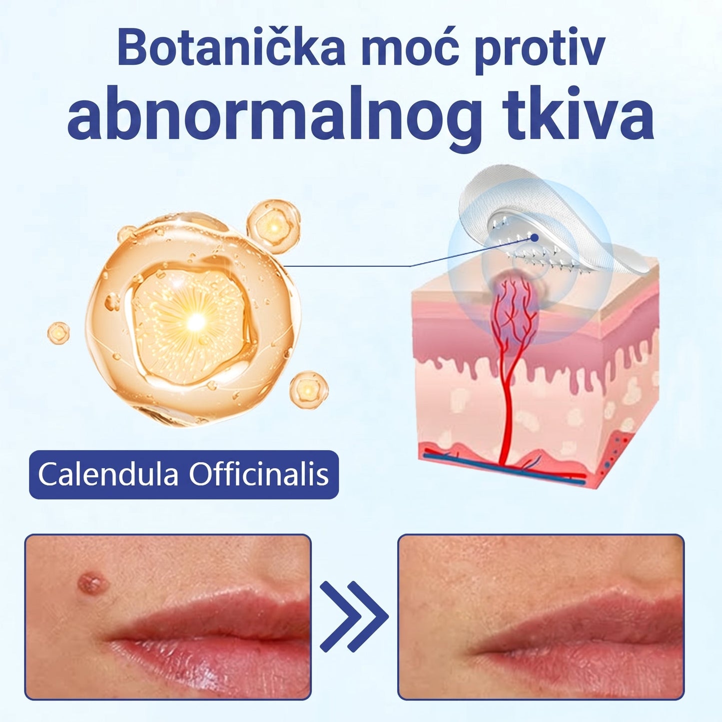 🔥Timilk® Dermalna Obnova 2-U-1 Mikroiglice & Hidrokoloidni flaster 💉| Sredstvo za uklanjanje podignutih madeža, akni, ravnih bradavica i kožnih izraslina | Ublažava bore, ožiljke i mrlje | Nevidljivi flasteri za prištiće za lice i tijelo💎