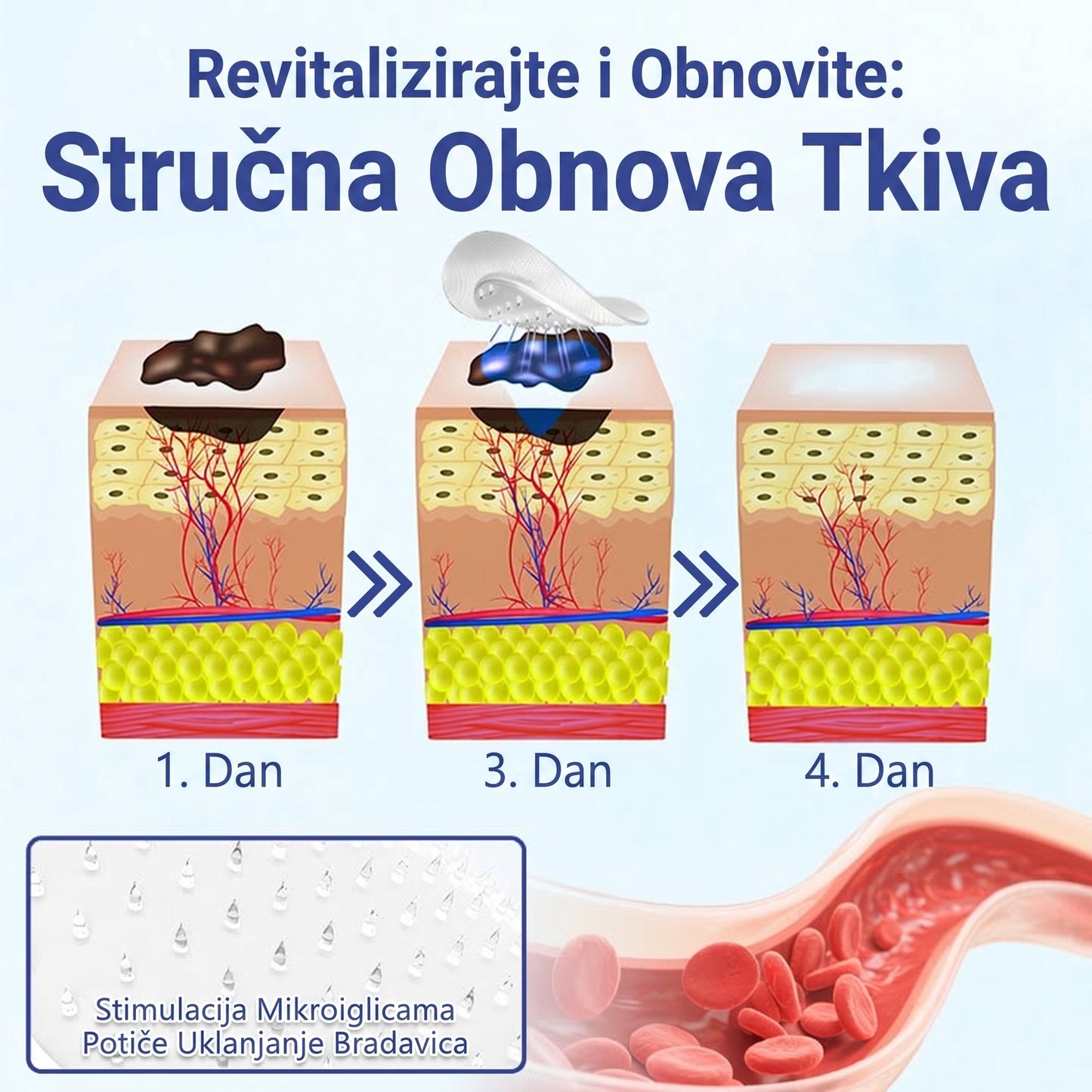 🔥Timilk® Dermalna Obnova 2-U-1 Mikroiglice & Hidrokoloidni flaster 💉| Sredstvo za uklanjanje podignutih madeža, akni, ravnih bradavica i kožnih izraslina | Ublažava bore, ožiljke i mrlje | Nevidljivi flasteri za prištiće za lice i tijelo💎