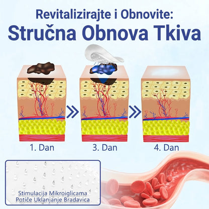 🔥Timilk® Dermalna Obnova 2-U-1 Mikroiglice & Hidrokoloidni flaster 💉| Sredstvo za uklanjanje podignutih madeža, akni, ravnih bradavica i kožnih izraslina | Ublažava bore, ožiljke i mrlje | Nevidljivi flasteri za prištiće za lice i tijelo💎