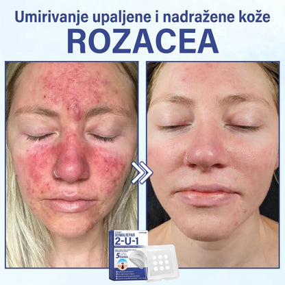 🔥Timilk® Dermalna Obnova 2-U-1 Mikroiglice & Hidrokoloidni flaster 💉| Sredstvo za uklanjanje podignutih madeža, akni, ravnih bradavica i kožnih izraslina | Ublažava bore, ožiljke i mrlje | Nevidljivi flasteri za prištiće za lice i tijelo💎