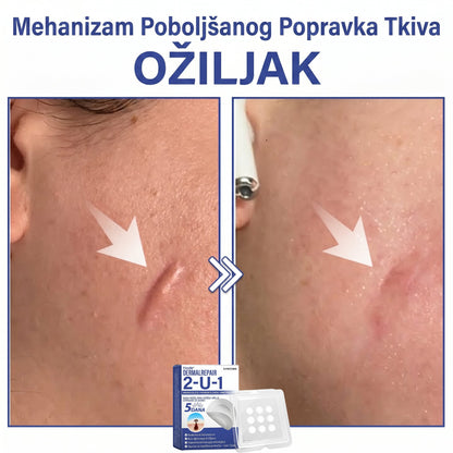 🔥Timilk® Dermalna Obnova 2-U-1 Mikroiglice & Hidrokoloidni flaster 💉| Sredstvo za uklanjanje podignutih madeža, akni, ravnih bradavica i kožnih izraslina | Ublažava bore, ožiljke i mrlje | Nevidljivi flasteri za prištiće za lice i tijelo💎
