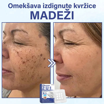 🔥Timilk® Dermalna Obnova 2-U-1 Mikroiglice & Hidrokoloidni flaster 💉| Sredstvo za uklanjanje podignutih madeža, akni, ravnih bradavica i kožnih izraslina | Ublažava bore, ožiljke i mrlje | Nevidljivi flasteri za prištiće za lice i tijelo💎