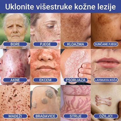 🔥Timilk® Dermalna Obnova 2-U-1 Mikroiglice & Hidrokoloidni flaster 💉| Sredstvo za uklanjanje podignutih madeža, akni, ravnih bradavica i kožnih izraslina | Ublažava bore, ožiljke i mrlje | Nevidljivi flasteri za prištiće za lice i tijelo💎
