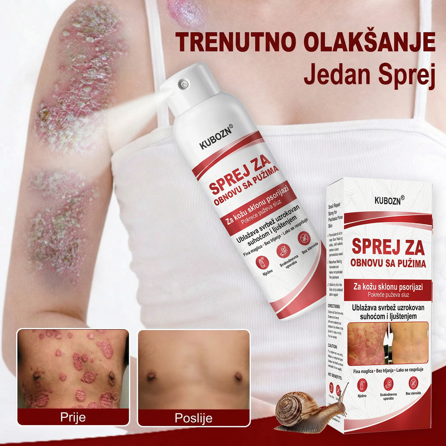 KUBOZN® SPREJ ZA OBNOVU SA PUZIMA za svrbežnu, perutavu kožu kod psorijaze