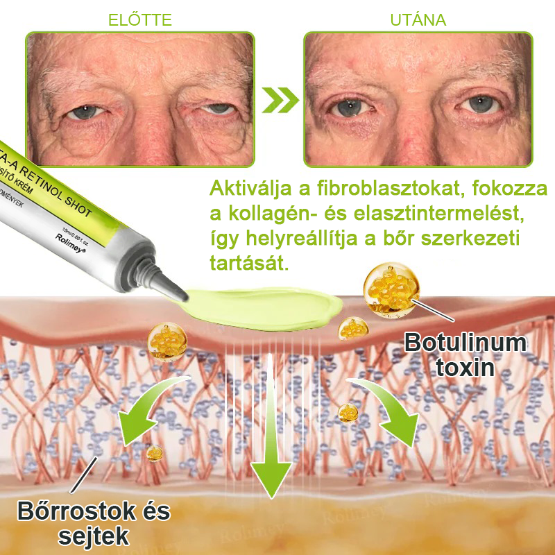 🌸Rolimey®Krema za učvršćivanje bora s botoksom i Vita-A retinolom ⏰ Zadnji dan! 70% popusta💡
