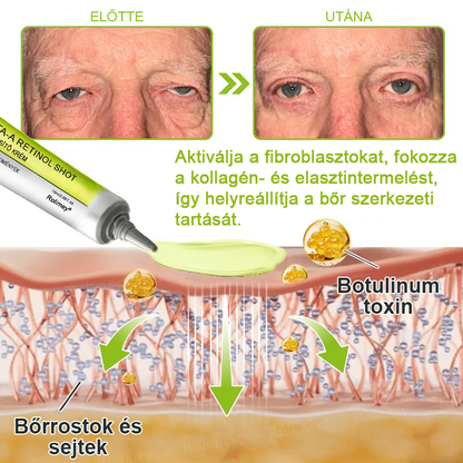 🌸Rolimey®Krema za učvršćivanje bora s botoksom i Vita-A retinolom ⏰ Zadnji dan! 70% popusta💡