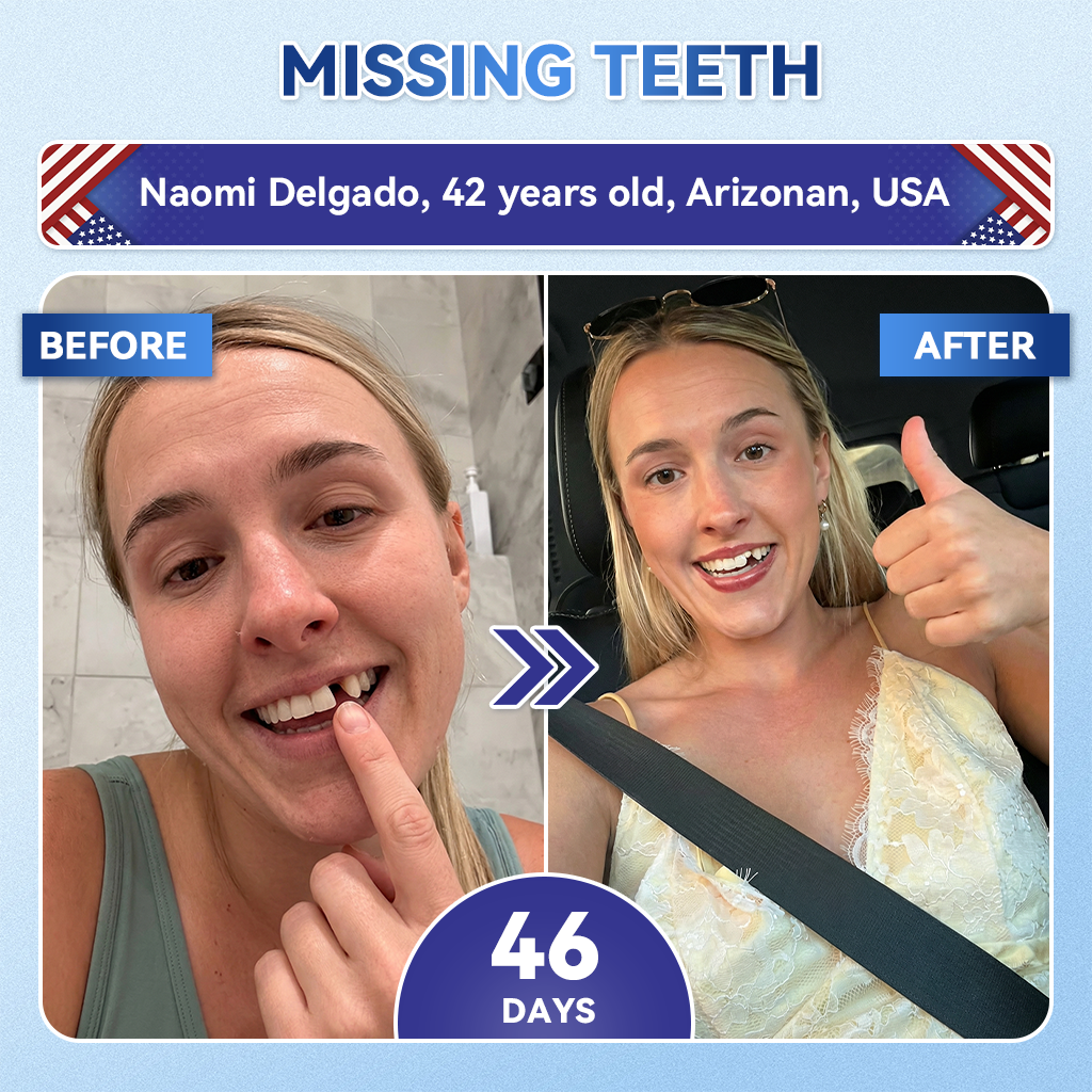 🦷𝐆𝐥𝐢𝐦𝐦𝐞𝐫𝐥𝐲® Tideglusib flaster s mikroiglama za popravak zubi i desni|Napredne trakice za aktivaciju matičnih stanica (obnavljaju caklinu i dentin, jačaju desni, uklanjaju kamenac i neugodne mirise, zaustavljaju osjetljivost zuba)) 3.0