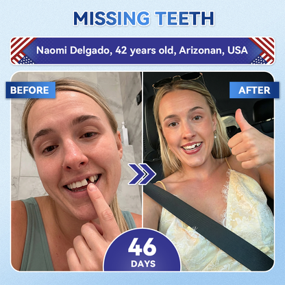 🦷𝐆𝐥𝐢𝐦𝐦𝐞𝐫𝐥𝐲® Tideglusib flaster s mikroiglama za popravak zubi i desni|Napredne trakice za aktivaciju matičnih stanica (obnavljaju caklinu i dentin, jačaju desni, uklanjaju kamenac i neugodne mirise, zaustavljaju osjetljivost zuba)) 3.0