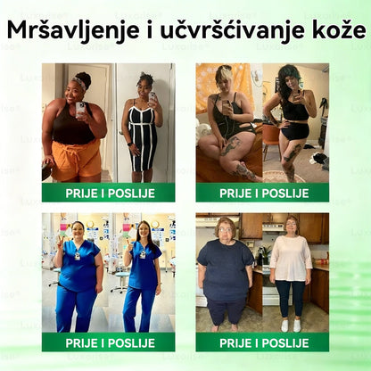 𝑺𝒍𝒖ž𝒃𝒆𝒏𝒂 𝒕𝒓𝒈𝒐𝒗𝒊𝒏𝒂  |  👩‍⚕️𝑳𝒖𝒙𝒂𝒓𝒊𝒔𝒆® 𝑴𝒐𝒓𝒊𝒏𝒈𝒂 𝑿 𝑩𝒆𝒓𝒃𝒆𝒓𝒊𝒏 10-𝑰𝒏-1 🌈𝑵𝒂𝒑𝒓𝒆𝒅𝒂𝒏 𝑵𝒂𝒏𝒐 𝑴𝒊𝒌𝒓𝒐𝒊𝒈𝒍𝒆 𝑭𝒍𝒂𝒔𝒕𝒆𝒓 (𝑱𝒆𝒅𝒏𝒐𝒎 𝒅𝒏𝒆𝒗𝒏𝒐, 𝒗𝒊𝒅𝒍𝒋𝒊𝒗𝒆 𝒑𝒓𝒐𝒎𝒋𝒆𝒏𝒆 𝒖 7 𝒅𝒂𝒏𝒂） 𝑷𝒓𝒆𝒕𝒊𝒍𝒐𝒔𝒕, 𝒅𝒊𝒋𝒂𝒃𝒆𝒕𝒆𝒔, 𝒂𝒑𝒏𝒆𝒋𝒂 𝒖 𝒔𝒏𝒖 𝒊 𝒑𝒓𝒐𝒃𝒍𝒆𝒎𝒊 𝒔𝒂 𝒛𝒈𝒍𝒐𝒃𝒐𝒗𝒊𝒎𝒂