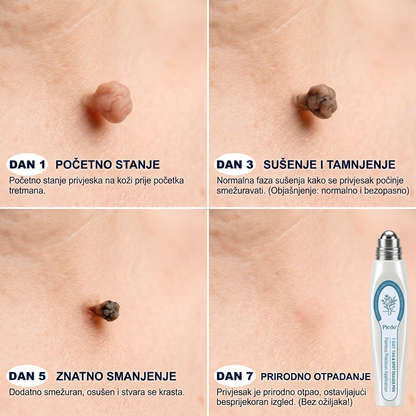 𝐏i𝐜𝐝o® 𝟕-𝐝𝐧𝐞𝐯𝐧𝐢 𝐨𝐝𝐬𝐭𝐫𝐚𝐧𝐣𝐢𝐯𝐚č 𝐛𝐫𝐚𝐝𝐚𝐯𝐢𝐜𝐚 𝐢 𝐦𝐫𝐥𝐢𝐚(Rollerball bez boli, bez ožiljaka)💪