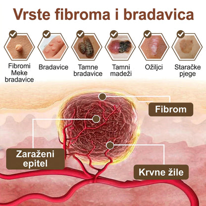 FIVFIVGO® Umirujuća krema za obnovu s crnom i bijelom rižom👨‍⚕️Odobrena od strane HALMED (Uklanjanje bradavica i kožnih izraslina, senilne purpure, angioma trešnje, raka kože i seboroične keratoze.👨‍⚕️