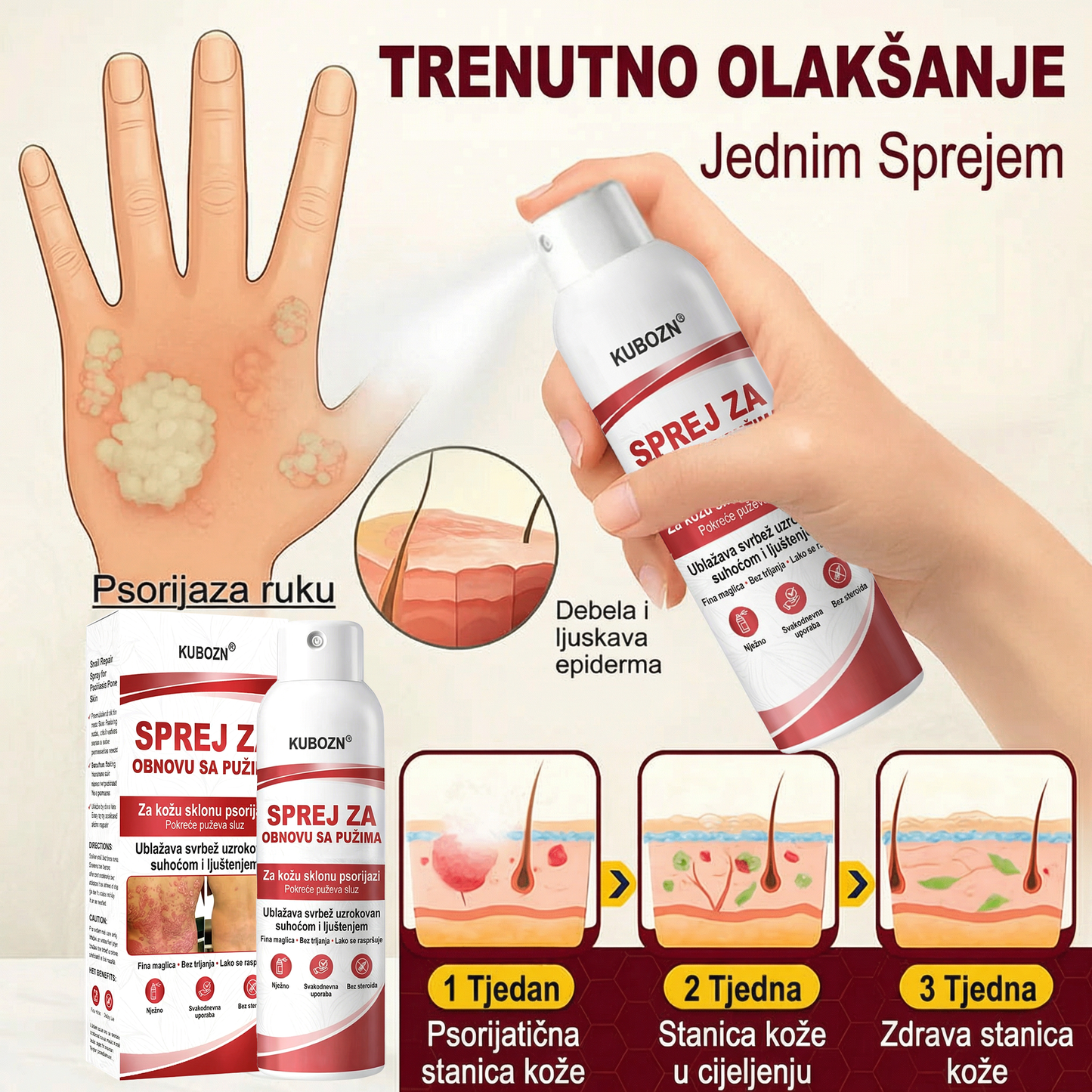 KUBOZN® SPREJ ZA OBNOVU SA PUZIMA za svrbežnu, perutavu kožu kod psorijaze
