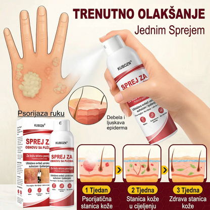 KUBOZN® SPREJ ZA OBNOVU SA PUZIMA za svrbežnu, perutavu kožu kod psorijaze
