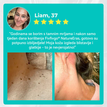✅Službena trgovina: Fivfivgo® NATUREERASE Trenutna krema za madeže i mrlje