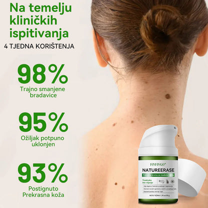 ✅Službena trgovina: Fivfivgo® NATUREERASE Trenutna krema za madeže i mrlje