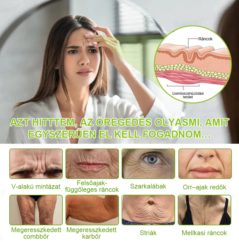 🌸Rolimey®Krema za učvršćivanje bora s botoksom i Vita-A retinolom ⏰ Zadnji dan! 70% popusta💡